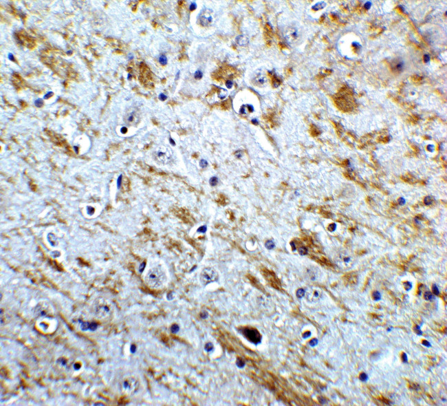 NELF Antibody in Immunohistochemistry (IHC)