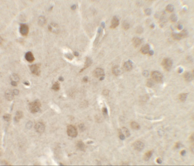 NELF Antibody in Immunohistochemistry (IHC)