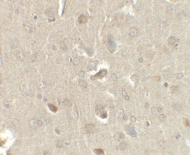 CCL4 Antibody in Immunohistochemistry (IHC)