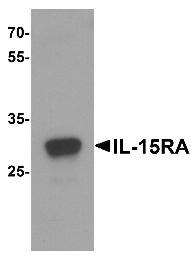 IL15RA Antibody in Western Blot (WB)