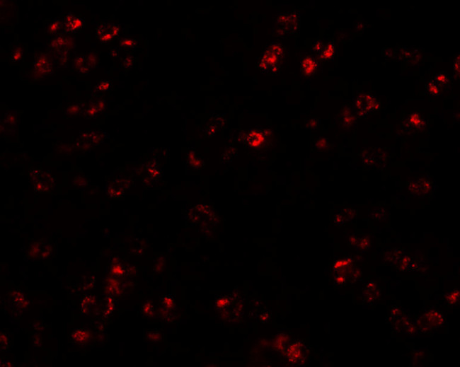 TARC Antibody in Immunohistochemistry (IHC)