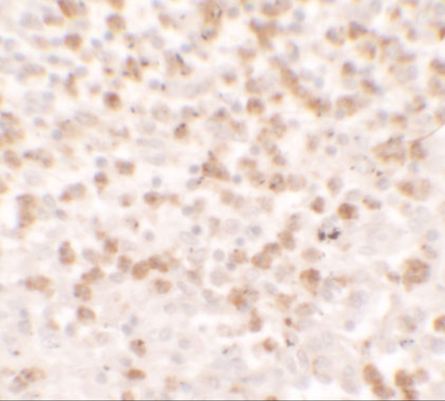 TARC Antibody in Immunohistochemistry (IHC)