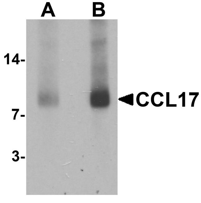 TARC Antibody in Western Blot (WB)