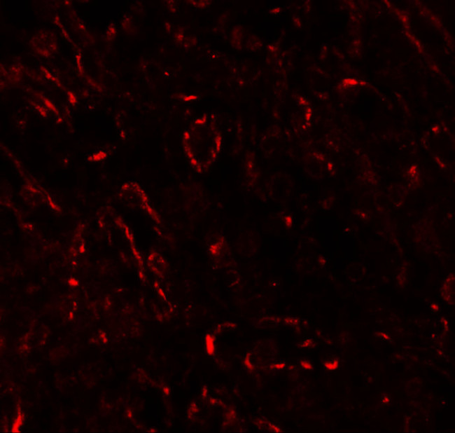 OX40L Antibody in Immunohistochemistry (IHC)