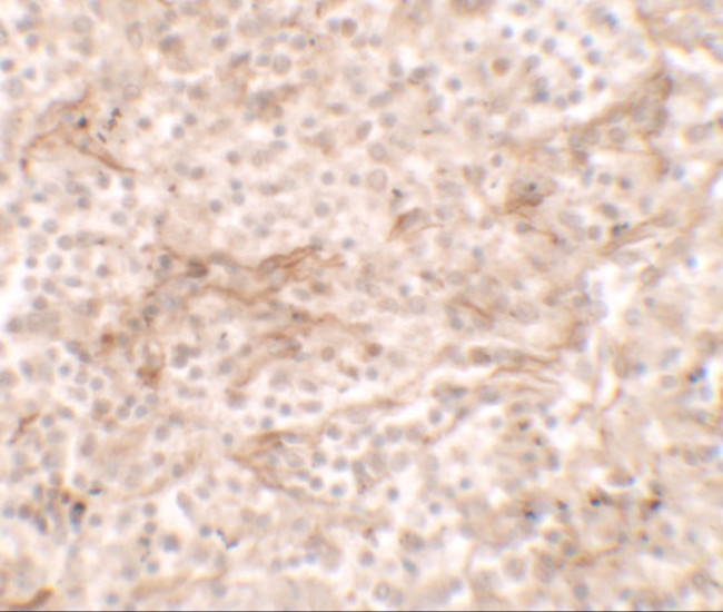 OX40L Antibody in Immunohistochemistry (IHC)