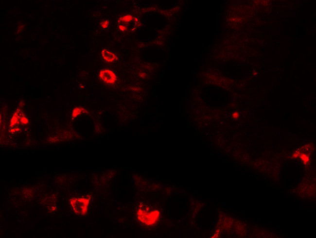 AGR2 Antibody in Immunohistochemistry (IHC)