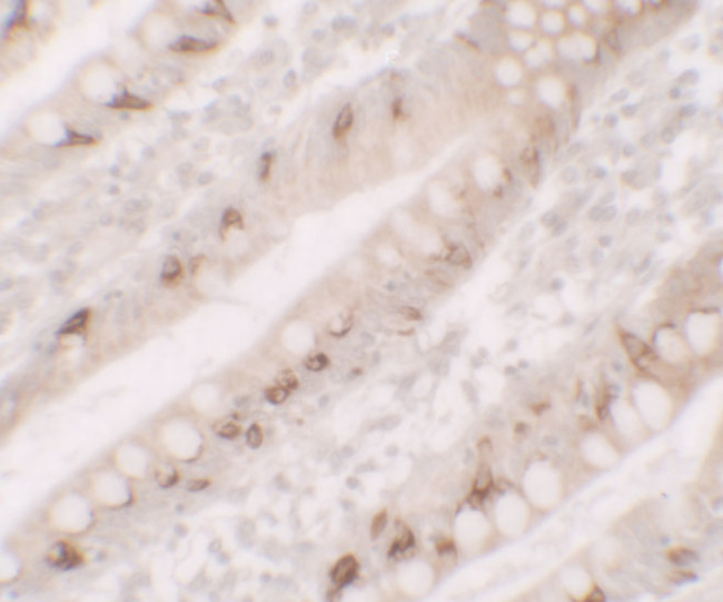 AGR2 Antibody in Immunohistochemistry (IHC)