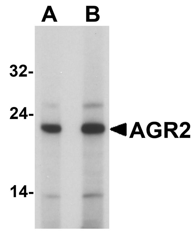 AGR2 Antibody in Western Blot (WB)