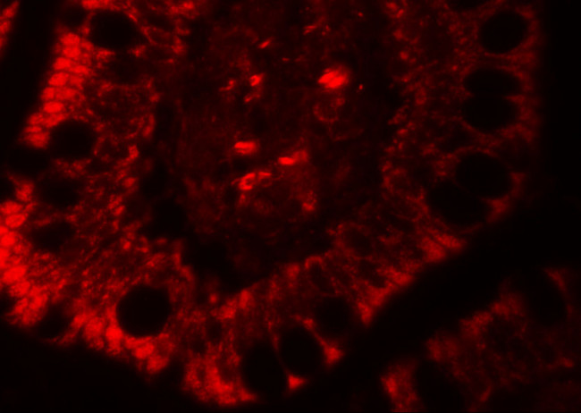 RC3H1 Antibody in Immunohistochemistry (IHC)