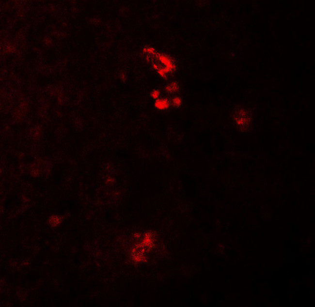 PRKCDBP Antibody in Immunohistochemistry (IHC)