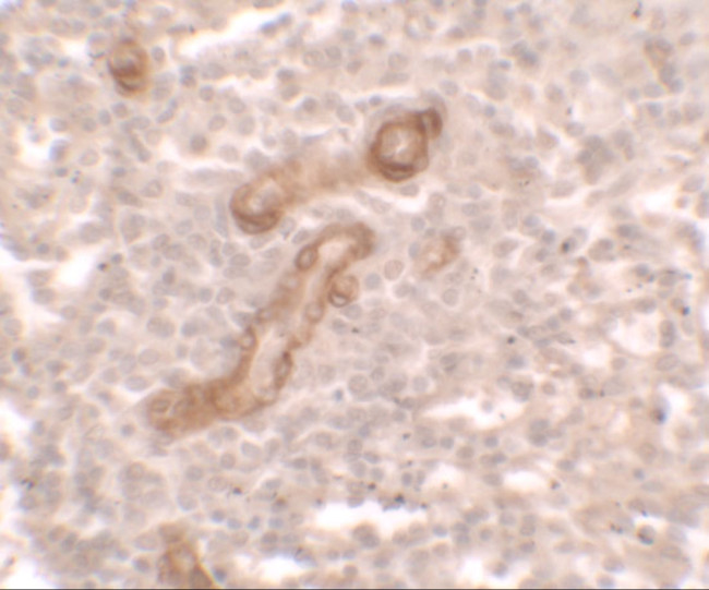 PRKCDBP Antibody in Immunohistochemistry (IHC)