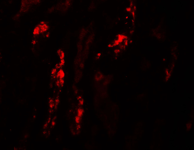 KANK1 Antibody in Immunohistochemistry (IHC)