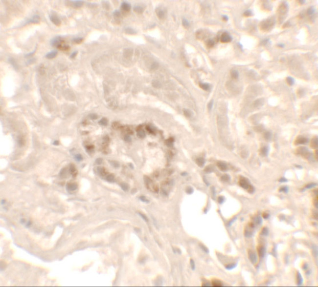 KANK1 Antibody in Immunohistochemistry (IHC)