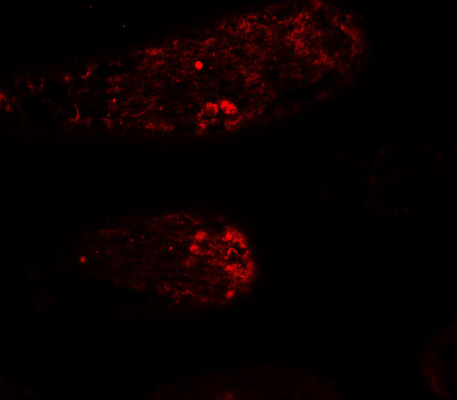 WAC Antibody in Immunohistochemistry (IHC)