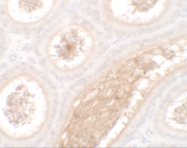 WAC Antibody in Immunohistochemistry (IHC)