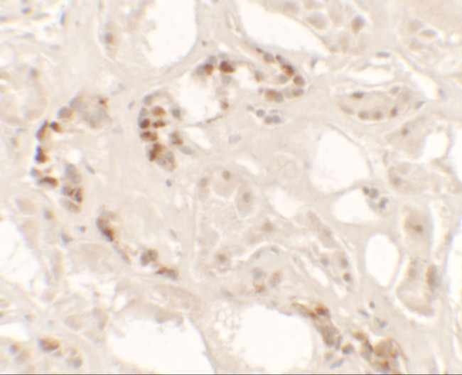 KANK2 Antibody in Immunohistochemistry (IHC)