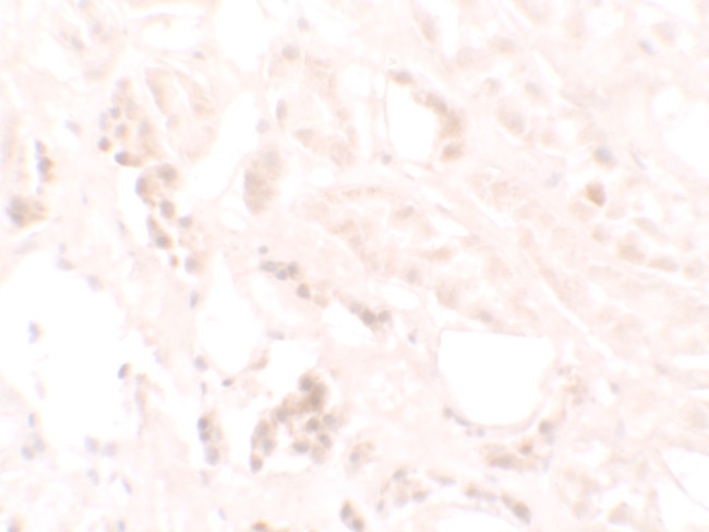 KANK3 Antibody in Immunohistochemistry (IHC)