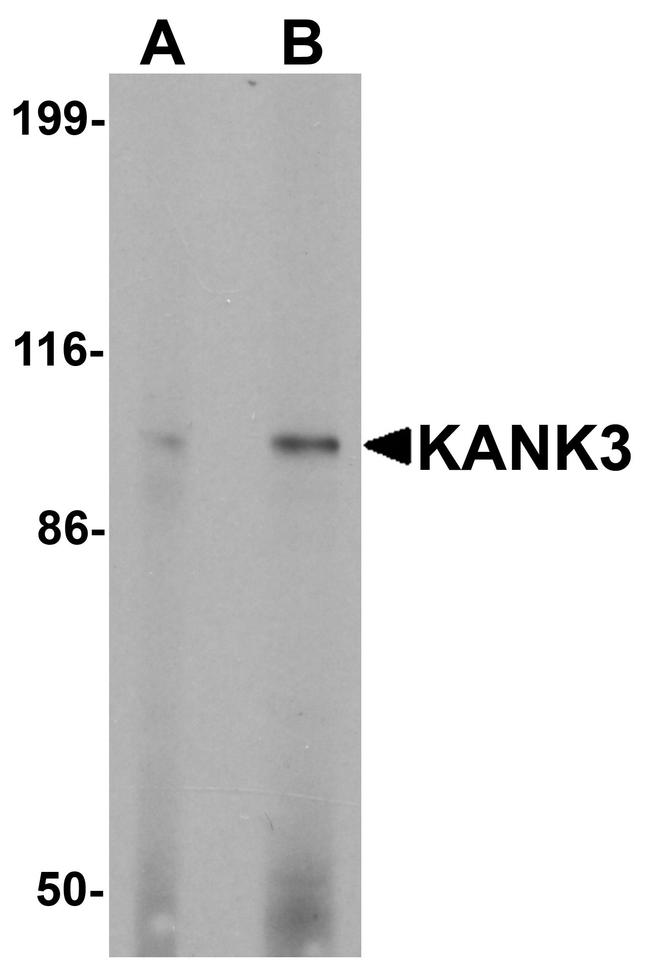 KANK3 Antibody in Western Blot (WB)