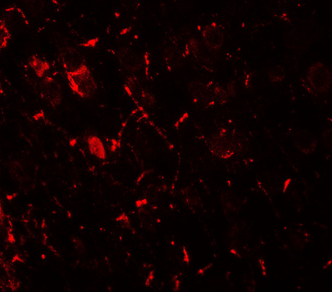 ULK1 Antibody in Immunohistochemistry (IHC)