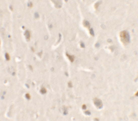 ULK1 Antibody in Immunohistochemistry (IHC)