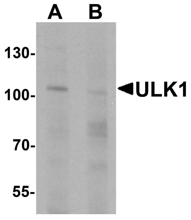 ULK1 Antibody in Western Blot (WB)