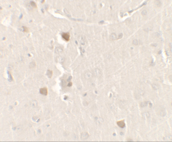 CISD2 Antibody in Immunohistochemistry (IHC)