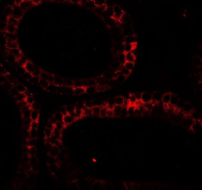 DIS3 Antibody in Immunohistochemistry (IHC)