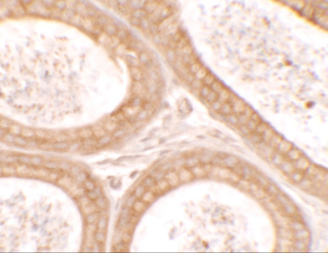 DIS3 Antibody in Immunohistochemistry (IHC)