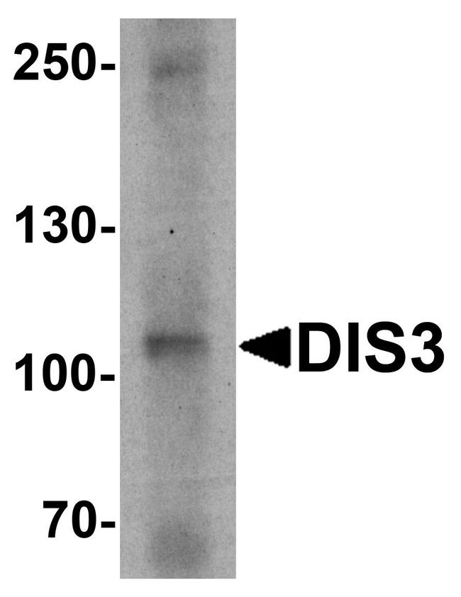 DIS3 Antibody in Western Blot (WB)