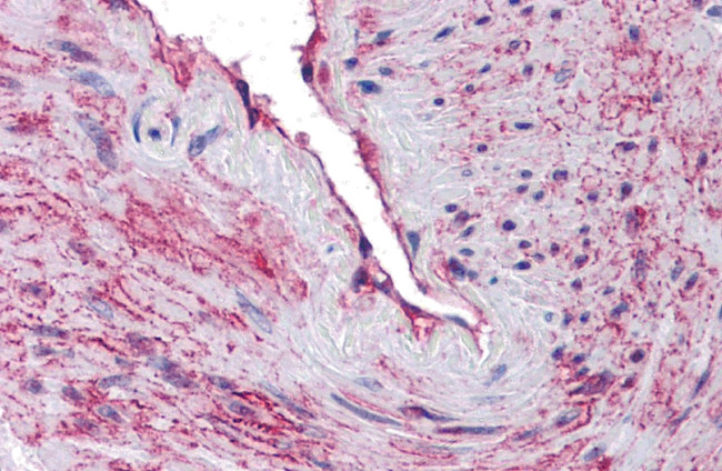 SCUBE3 Antibody in Immunohistochemistry (IHC)