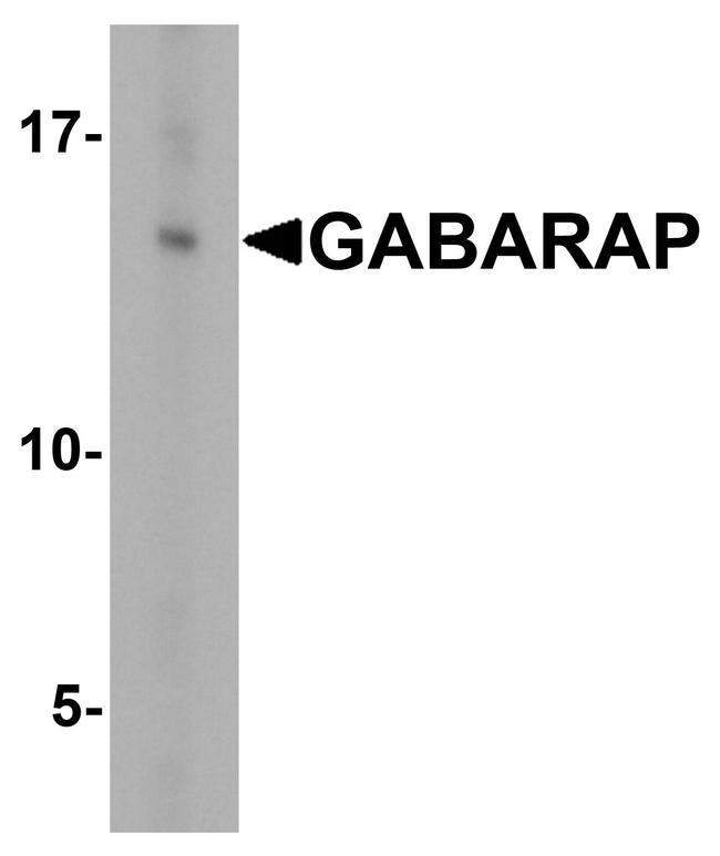 GABARAP Antibody in Western Blot (WB)