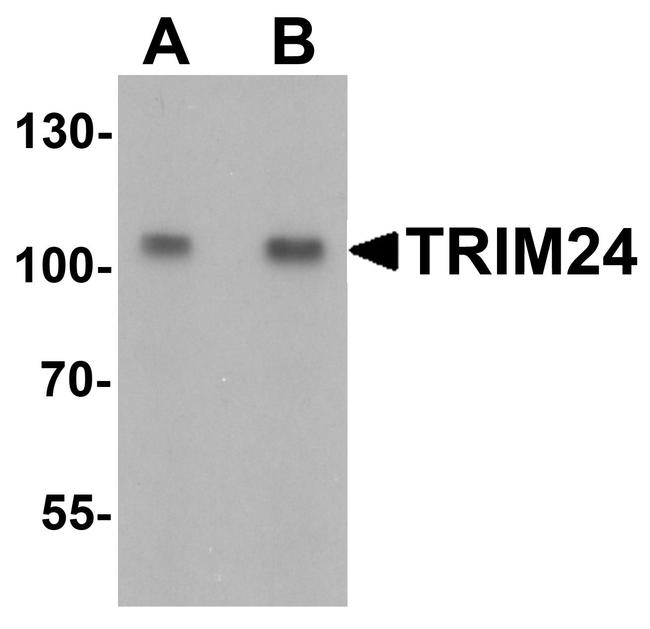 TRIM24 Antibody in Western Blot (WB)