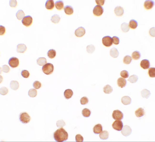 NCBP1 Antibody in Immunocytochemistry (ICC/IF)