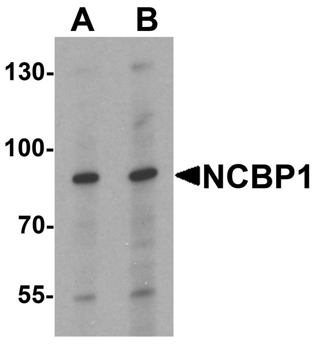 NCBP1 Antibody in Western Blot (WB)