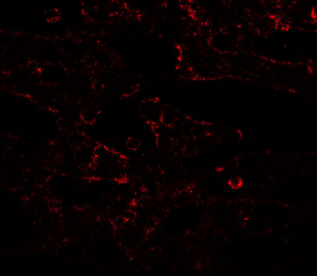 IL17RA Antibody in Immunohistochemistry (IHC)