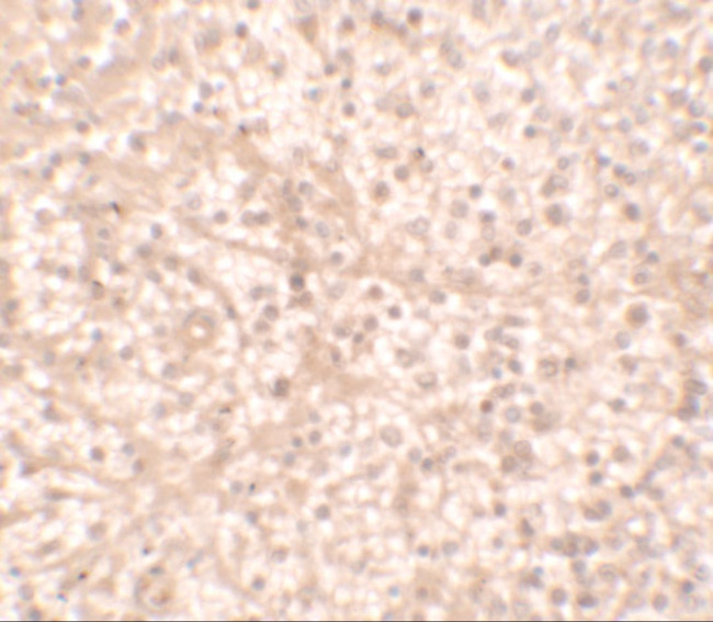 IL17RA Antibody in Immunohistochemistry (IHC)