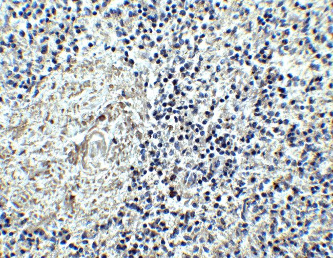 IL17RA Antibody in Immunohistochemistry (IHC)