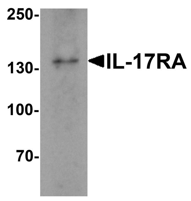 IL17RA Antibody in Western Blot (WB)