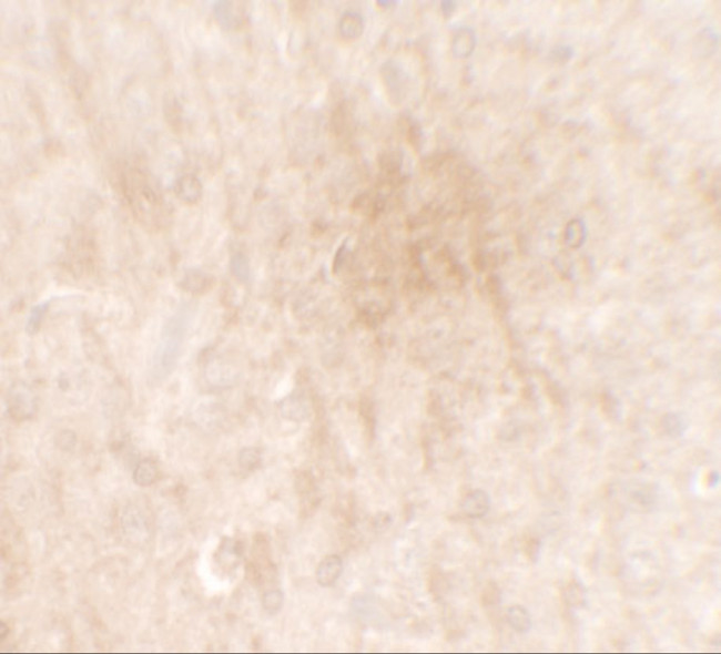 FGFR3 Antibody in Immunohistochemistry (IHC)