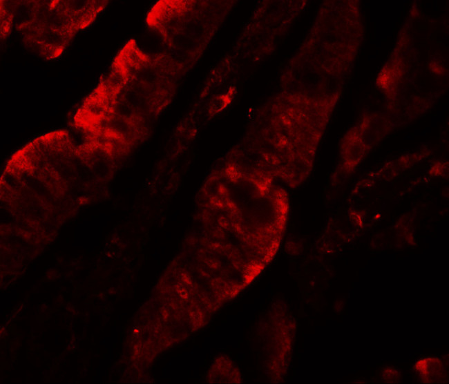 TFPI Antibody in Immunohistochemistry (IHC)