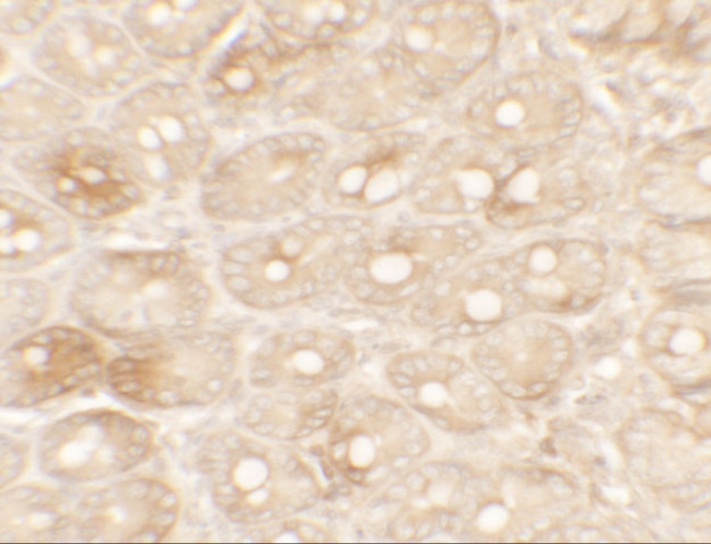 TFPI Antibody in Immunohistochemistry (IHC)