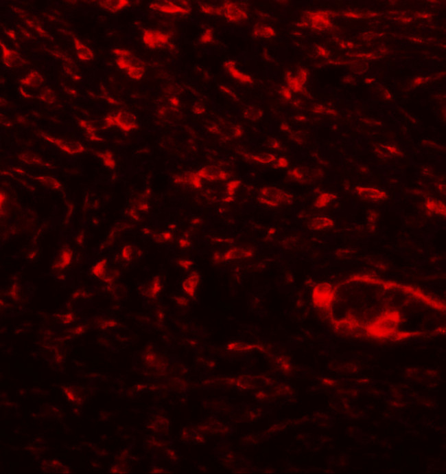 Osteopontin Antibody in Immunohistochemistry (IHC)