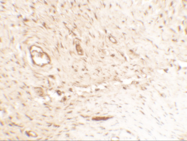 Osteopontin Antibody in Immunohistochemistry (IHC)