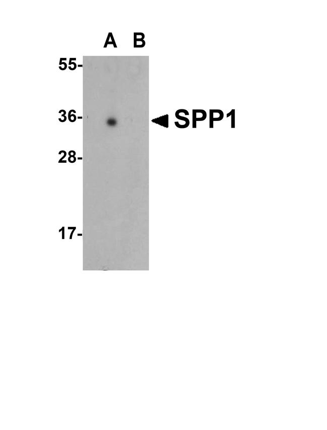 Osteopontin Antibody in Western Blot (WB)