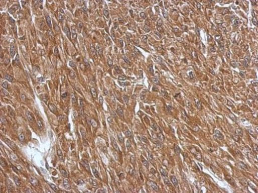 GPR37L1 Antibody in Immunohistochemistry (Paraffin) (IHC (P))