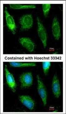 ALDH1A1 Antibody in Immunocytochemistry (ICC/IF)