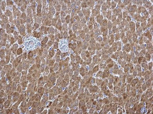 ALDH1A1 Antibody in Immunohistochemistry (Paraffin) (IHC (P))