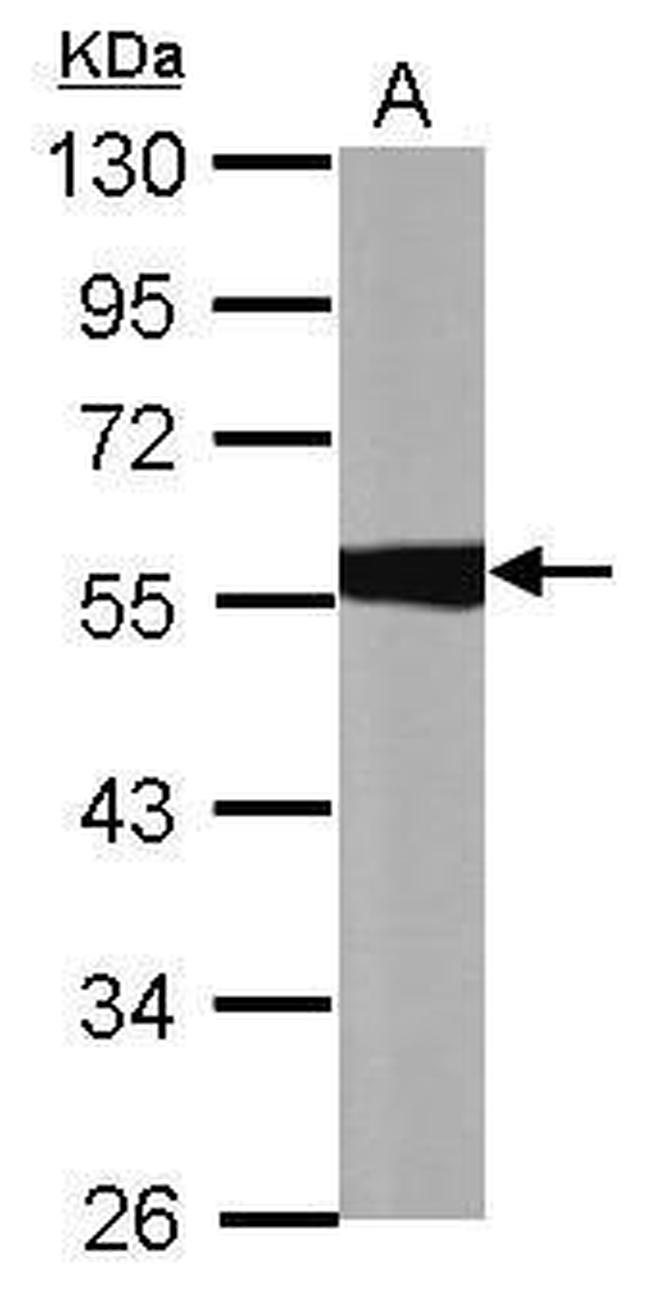 ALDH1A1 Antibody in Western Blot (WB)