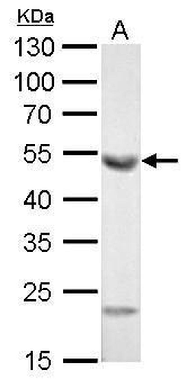 ALDH1A1 Antibody in Western Blot (WB)