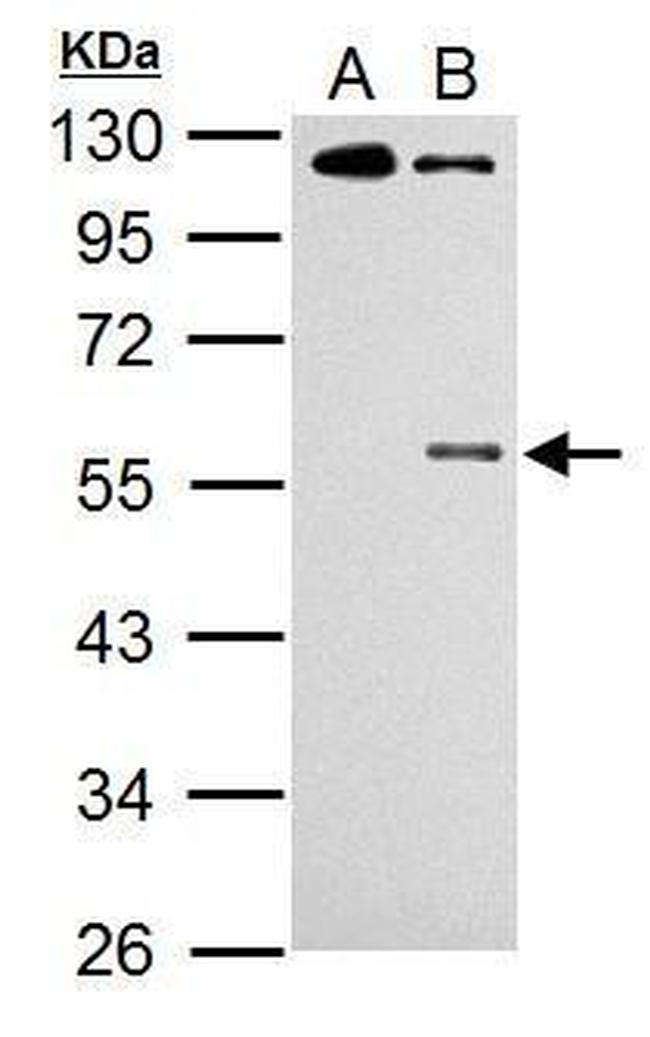 Phospho-CHK1 (Ser345) Antibody in Western Blot (WB)